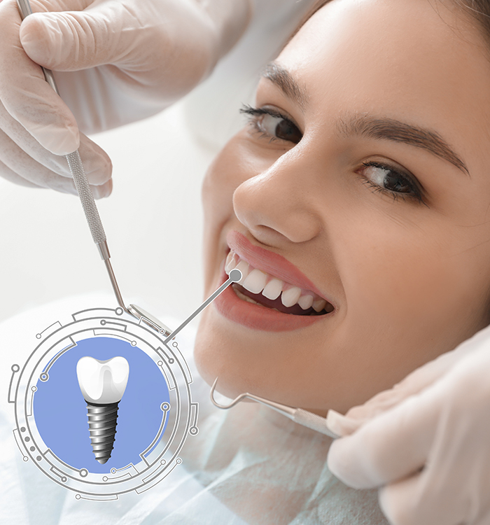 Dental implants application available at SnB Aesthetic Clinic in Dubai UAE