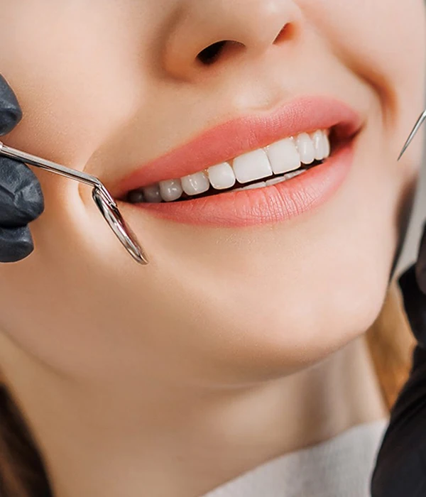 Cosmetic Dentistry service offered at SnB Aesthetic Clinic in Dubai UAE