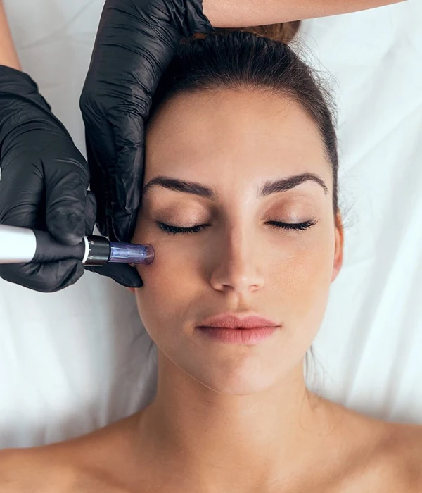 Microneedling aesthetic treatment available at SnB Aesthetic Clinic in Dubai UAE